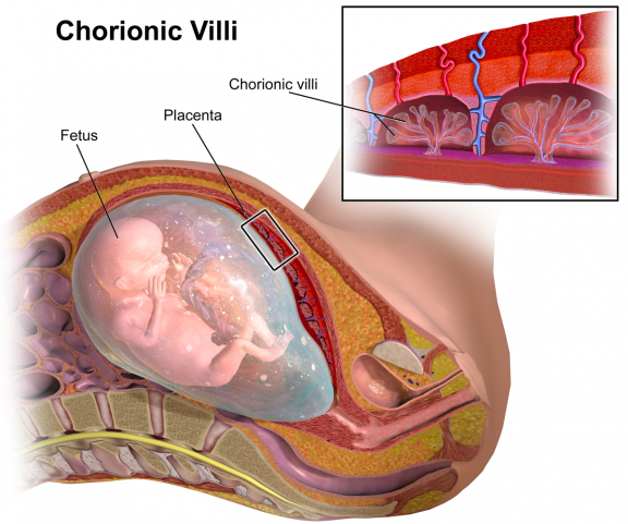 ChorionicVillus